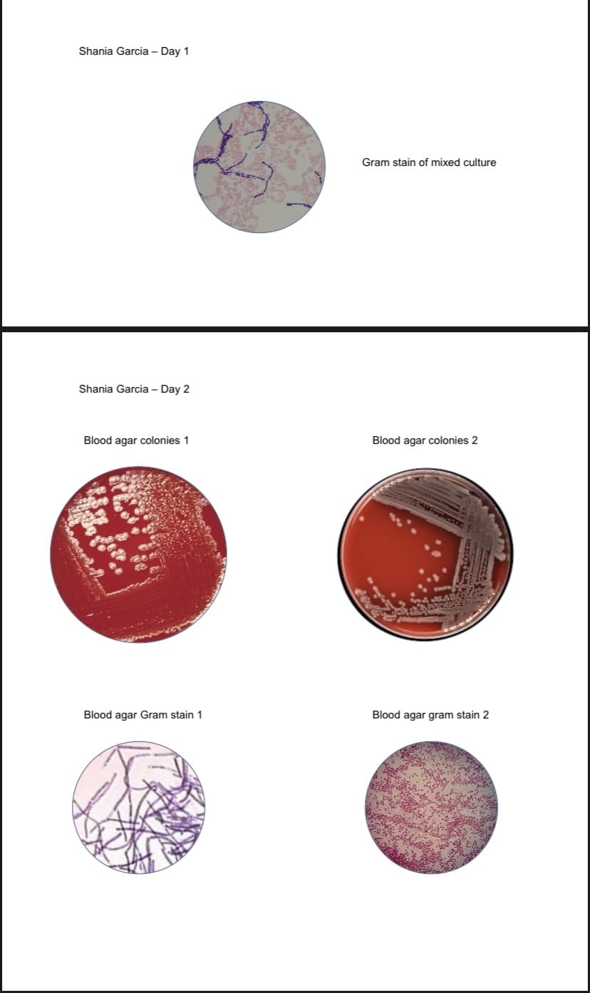 Shania Garcia - Day 1
Gram stain of mixed culture
Shania Garcia - Day 2
Blood agar colonies 1
Blood agar colonies 2
Blood agar Gram stain 1
Blood agar gram stain 2
