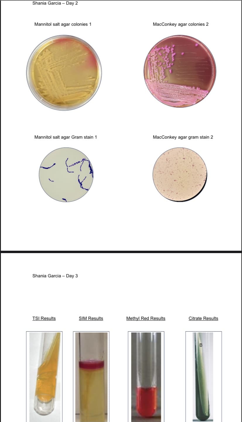 Shania Garcia - Day 2
Mannitol salt agar colonies 1
MacConkey agar colonies 2
Mannitol salt agar Gram stain 1
MacConkey agar gram stain 2
Shania Garcia – Day 3
TSI Results
SIM Results
Methyl Red Results
Citrate Results
