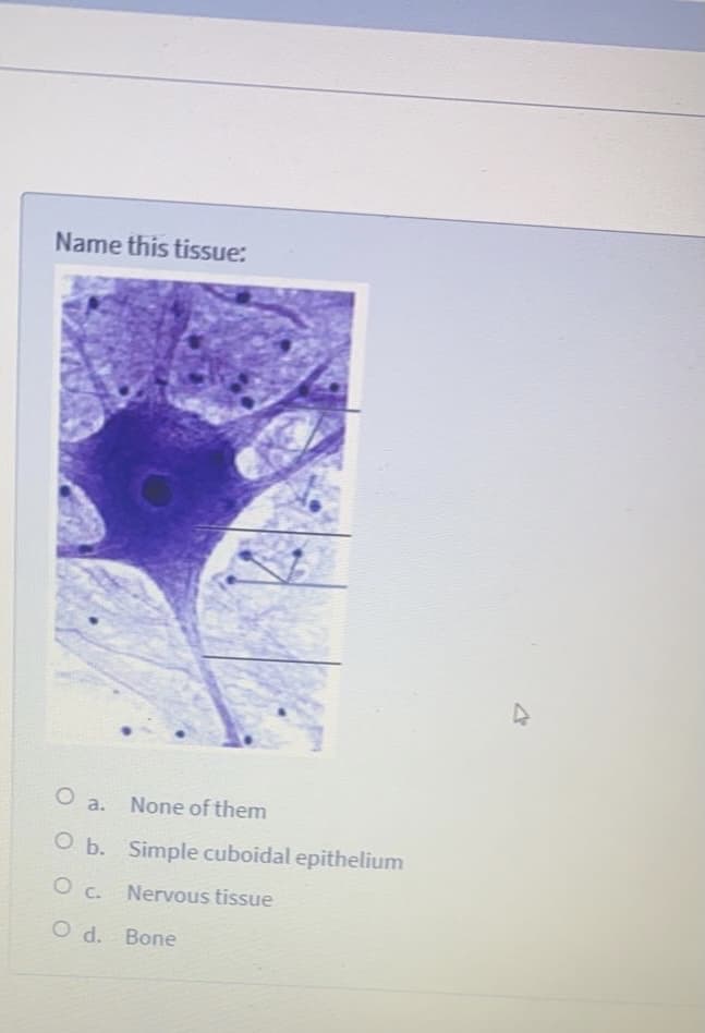 Name this tissue:
None of them
O a.
O b. Simple cuboidal epithelium
Nervous tissue
O d. Bone
