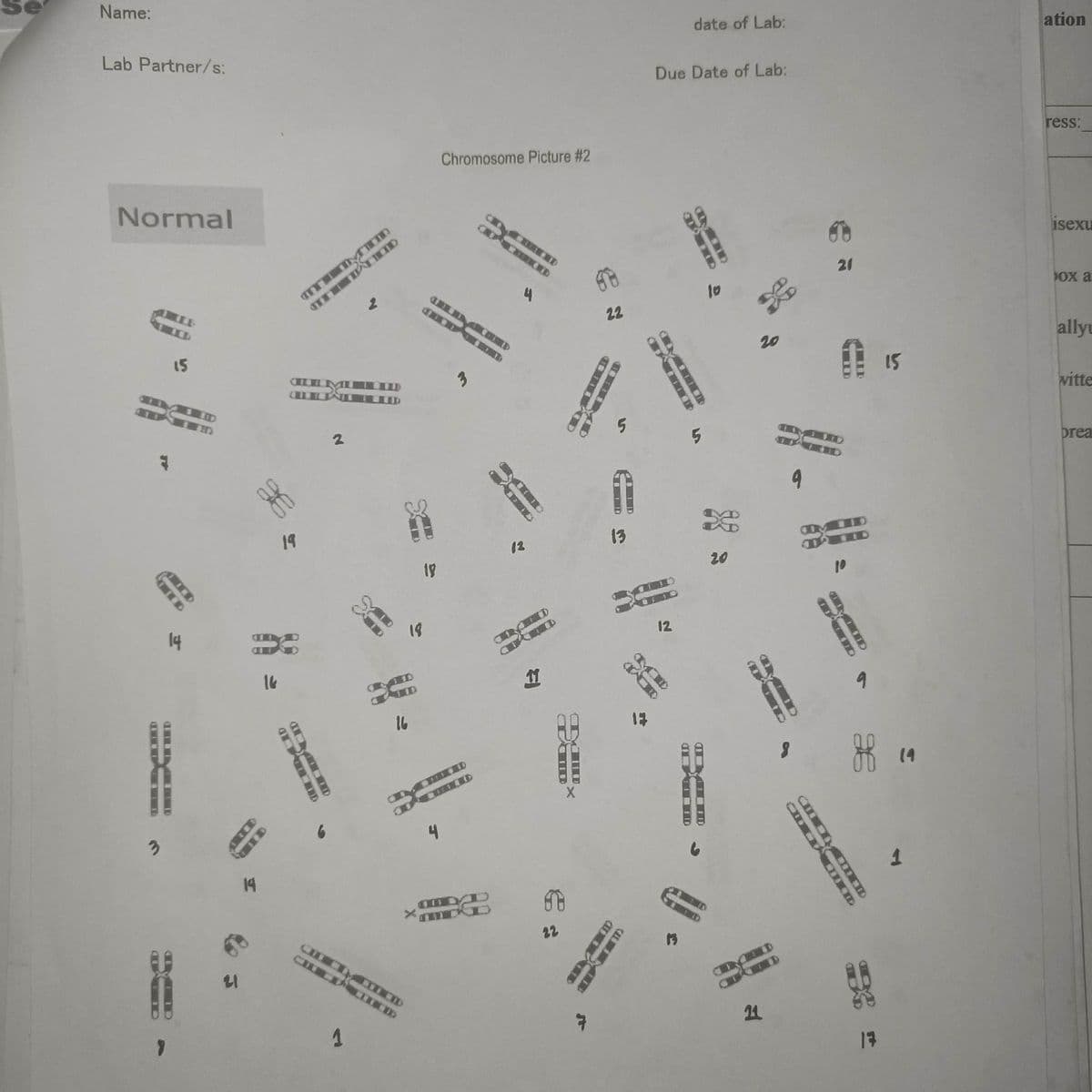 Name:
Lab Partner/s:
Normal
m
4
15
14
21
gf
19
14
16
LD
TO
TOD
CHATTIE
19
2
யம்
1
16
18
X
CHILCIVID
19
4
Chromosome Picture #2
LIMEND
M
OUD
C
13
D
CADD
11
CAID
20
22
E
5
22
STAND
13
CI
13
Due Date of Lab:
ZO
12
date of Lab:
13
5
D
ww
20
20
11
4
9
AID
21
115
10
9
of 19
DE
17
1
ation
ress:
isexu
ox a
allyu
witte
prea