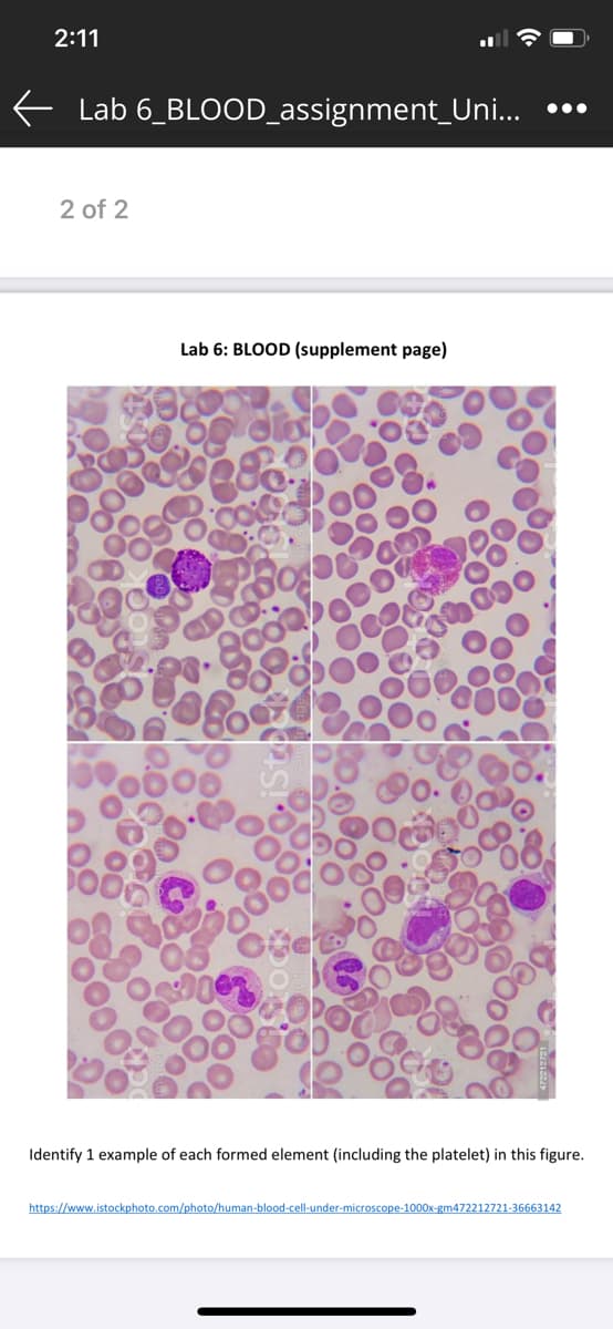 2:11
Lab 6_BLOOD_assignment_Uni...
•..
2 of 2
Lab 6: BLOOD (supplement page)
Identify 1 example of each formed element (including the platelet) in this figure.
https://www.istockphoto.com/photo/human-blood-cell-under-microscope-1000x-gm472212721-36663142
