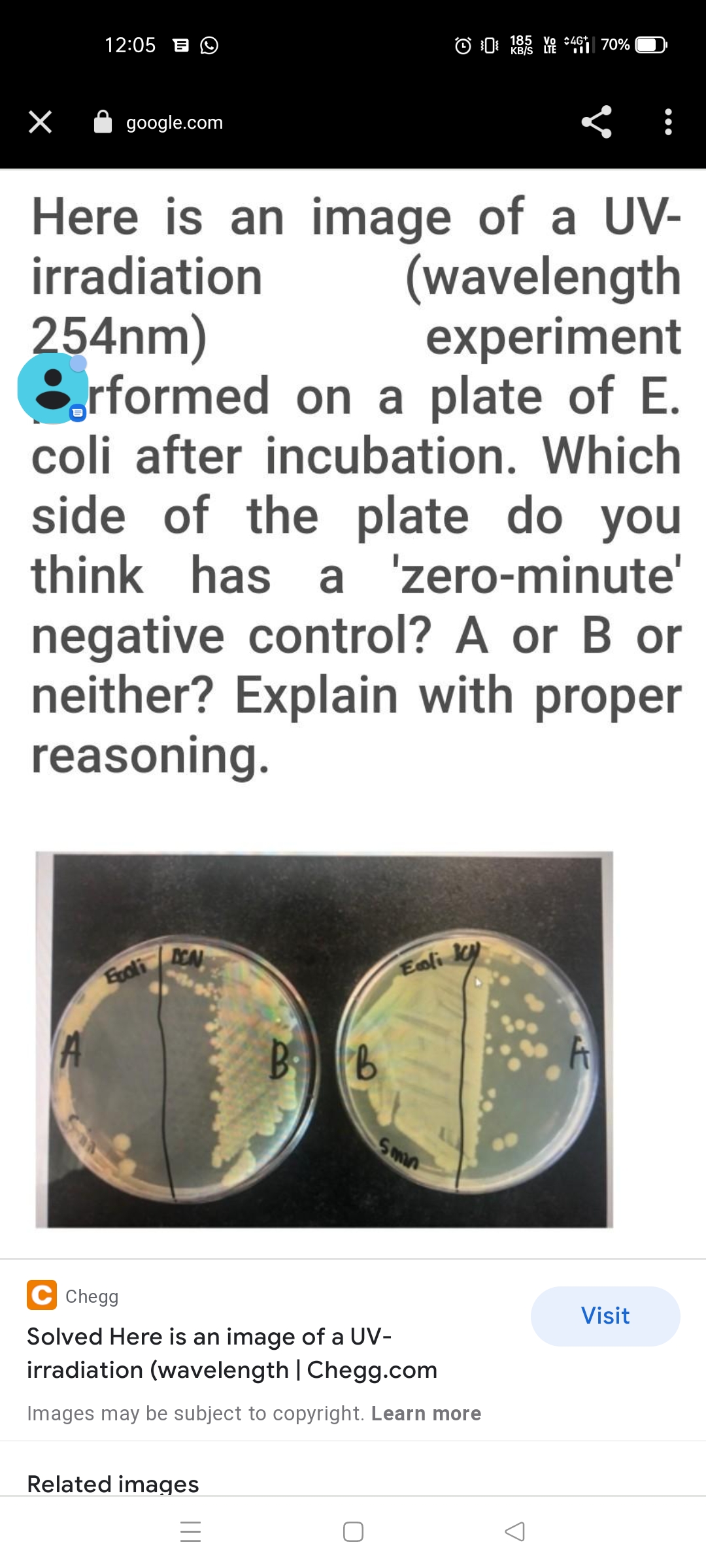 12:05 B O
185
google.com
Here is an image of a UV-
irradiation
(wavelength
experiment
254nm)
rformed on a plate of E.
coli after incubation. Which
side of the plate do you
think has a 'zero-minute'
negative control? A or B or
neither? Explain with proper
reasoning.
DEN
Exoli
Eoli ky
Chegg
Visit
Solved Here is an image of a UV-
irradiation (wavelength | Chegg.com
Images may be subject to copyright. Learn more
Related images
