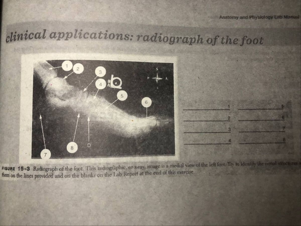 clinical applications: radiograph of the foot
8
5
Anatomy and Physiology Lab Manual
6
FIGURE 15-3 Radiograph of the foot. This radiographic, or x-ray, image is a medial view of the left foot. Try to identify the noted structures
them on the lines provided and on the blanks on the Lab Report at the end of this exercise.