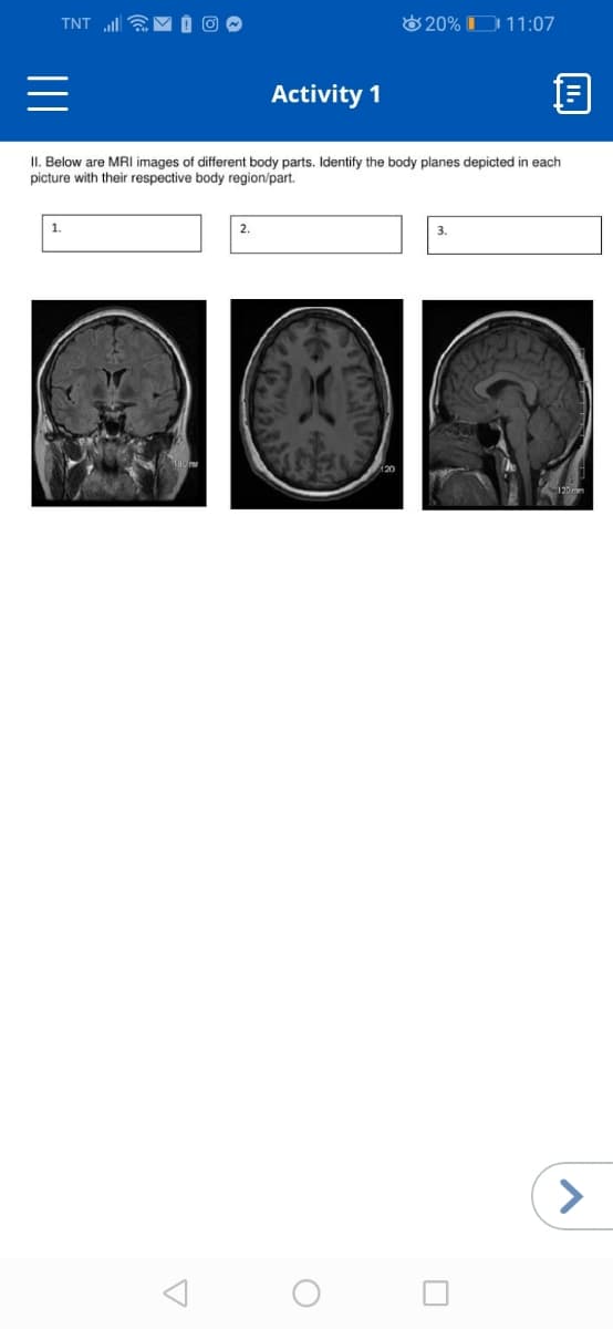 TNT ll a
O 20% D 11:07
Activity 1
II. Below are MRI images of different body parts. Identify the body planes depicted in each
picture with their respective body region/part.
1.
2.
3.
