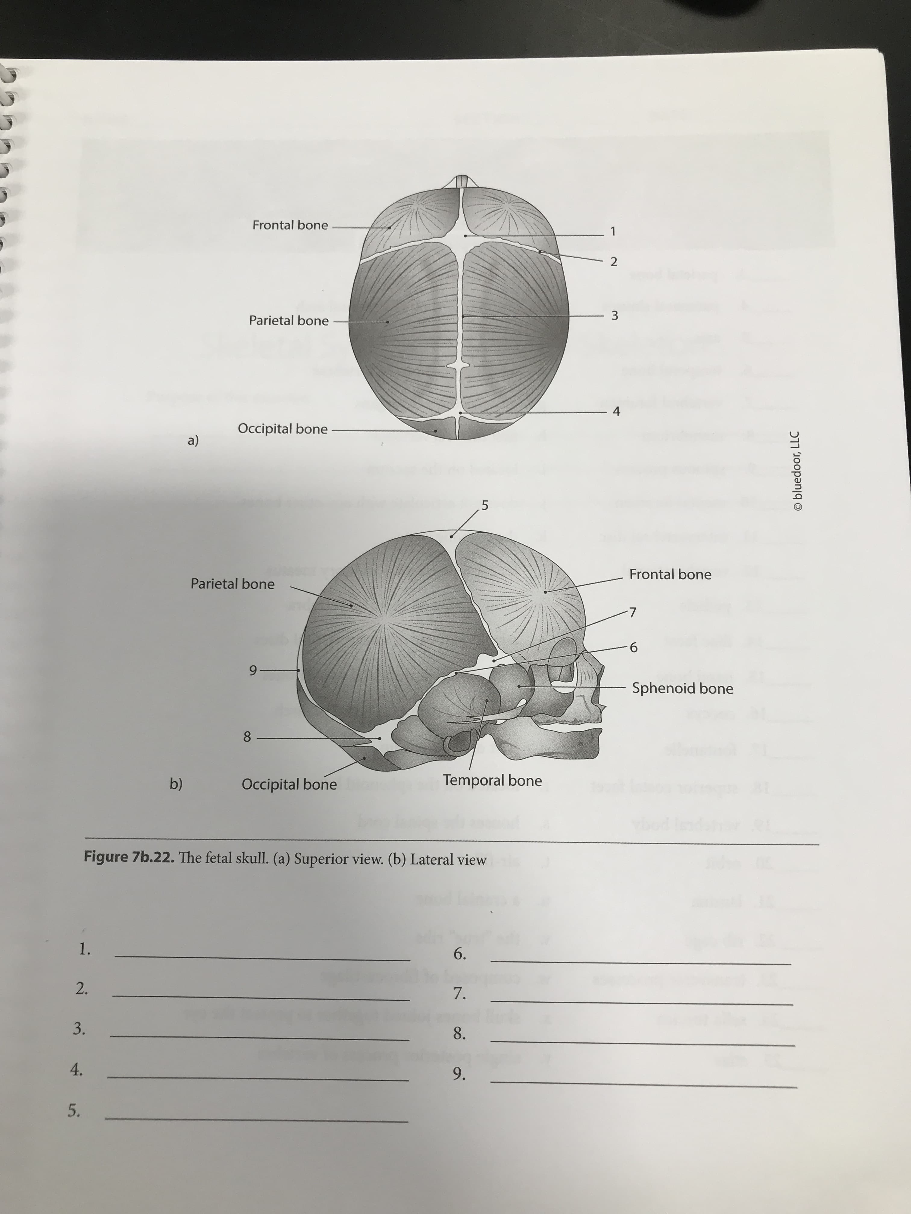 Frontal bone
2
Parietal bone
4
Occipital bone
a)
Frontal bone
Parietal bone
7.
б
9-
Sphenoid bone
8.
b)
Occipital bone
Temporal bone
Figure 7b.22. The fetal skull. (a) Superior view. (b) Lateral view
1.
6.
2.
7.
3.
8.
4.
9.
© bluedoor, LLC
3.
5.
