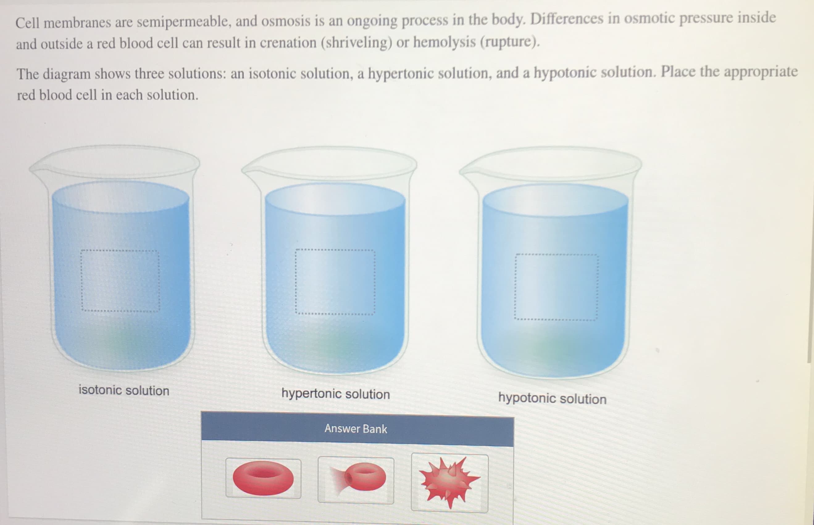 Cell membranes are semipermeable, and osmosis is an ongoing process in the body. Differences in osmotic pressure inside
and outside a red blood cell can result in crenation (shriveling) or hemolysis (rupture).
The diagram shows three solutions: an isotonic solution, a hypertonic solution, and a hypotonic solution. Place the appropriate
red blood cell in each solution.
isotonic solution
hypertonic solution
hypotonic solution
Answer Bank
