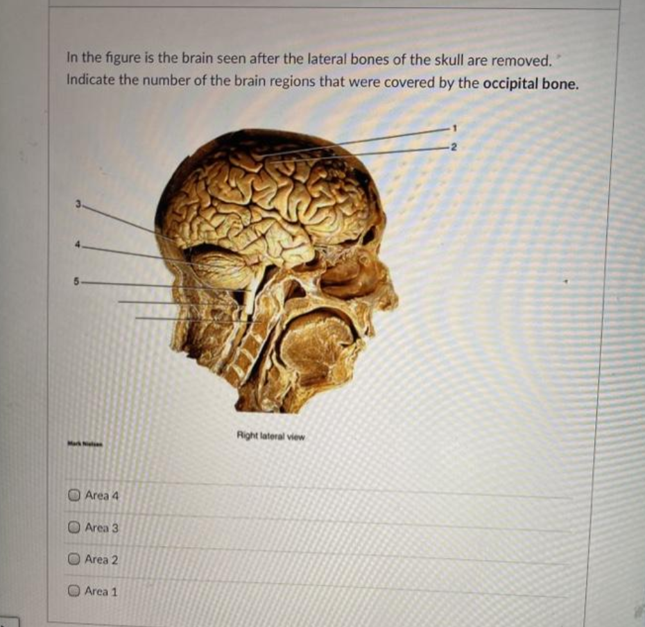 In the figure is the brain seen after the lateral bones of the skull are removed.
Indicate the number of the brain regions that were covered by the occipital bone.
5-
Right lateral view
Mark
Area 4
O Area 3
Area 2
O Area 1
