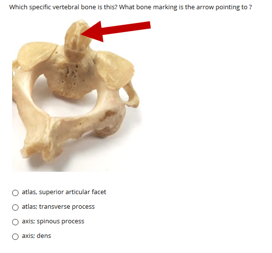 Which specific vertebral bone is this? What bone marking is the arrow pointing to ?
atlas, superior articular facet
atlas; transverse process
axis; spinous process
axis; dens
