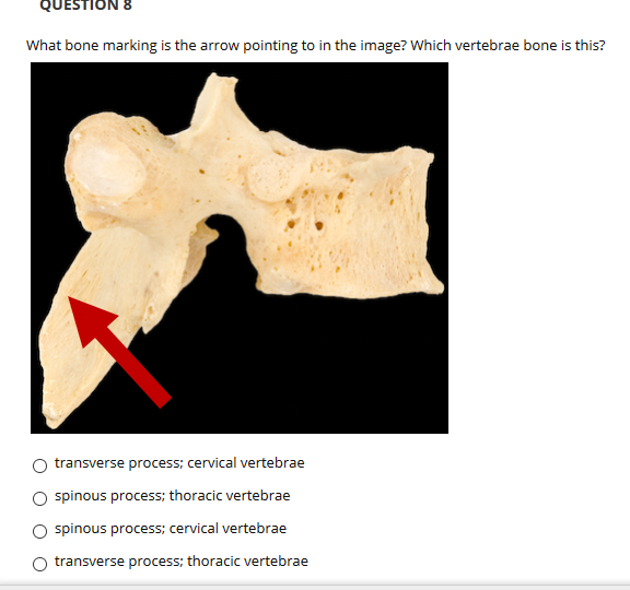 QUESTION
What bone marking is the arrow pointing to in the image? Which vertebrae bone is this?
transverse process; cervical vertebrae
spinous process; thoracic vertebrae
spinous process; cervical vertebrae
transverse process; thoracic vertebrae
