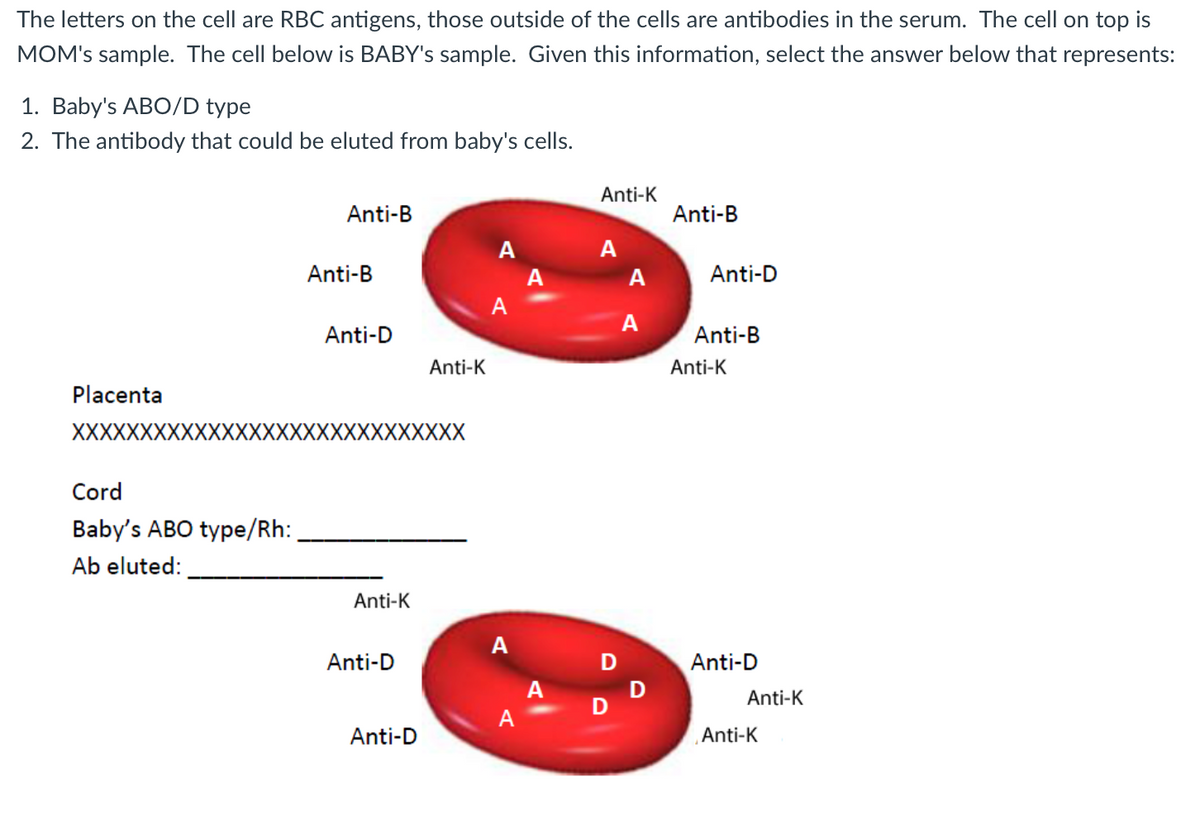 The letters on the cell are RBC antigens, those outside of the cells are antibodies in the serum. The cell on top is
MOM's sample. The cell below is BABY's sample. Given this information, select the answer below that represents:
1. Baby's ABO/D type
2. The antibody that could be eluted from baby's cells.
Placenta
XXXXXXXX
Cord
Baby's ABO type/Rh:
Ab eluted:
Anti-B
Anti-B
Anti-D
XXXXXXXX
Anti-K
Anti-D
Anti-K
Anti-D
A
A
A
A
A
A
Anti-K
A
D
D
A
A
D
Anti-B
Anti-D
Anti-B
Anti-K
Anti-D
Anti-K
Anti-K