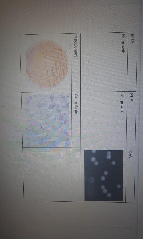 MSA
PEA
TSA
No growth
No growth
ARDY
MacConkey
Gram Stain
