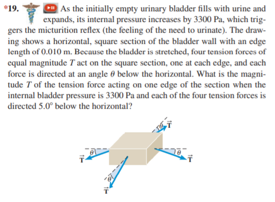 | As the initially empty urinary bladder fills with urine and
expands, its internal pressure increases by 3300 Pa, which trig-
gers the micturition reflex (the feeling of the need to urinate). The draw-
ing shows a horizontal, square section of the bladder wall with an edge
length of 0.010 m. Because the bladder is stretched, four tension forces of
equal magnitude T act on the square section, one at each edge, and each
force is directed at an angle 0 below the horizontal. What is the magni-
tude T of the tension force acting on one edge of the section when the
internal bladder pressure is 3300 Pa and each of the four tension forces is
*19.
directed 5.0° below the horizontal?
