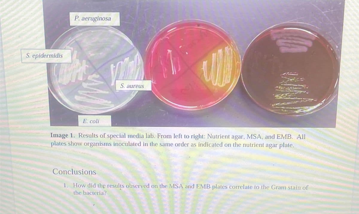 S. epidermidis
P. aeruginosa
S. aureus
E. coli
Image 1. Results of special media lab. From left to right: Nutrient agar, MSA, and EMB. All
plates show organisms inoculated in the same order as indicated on the nutrient agar plate.
Conclusions
1. How did the results observed on the MSA and EMB plates correlate to the Gram stain of
the bacteria?