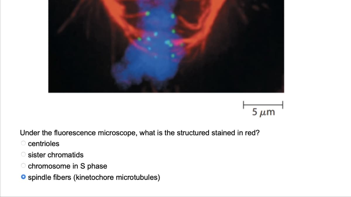 5 μm
Under the fluorescence microscope, what is the structured stained in red?
O centrioles
O sister chromatids
Ochromosome in S phase
spindle fibers (kinetochore microtubules)