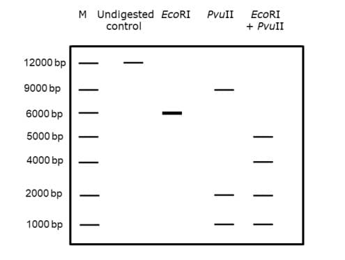 M Undigested ECORI
control
PvuII
ECORI
+ PvuII
12000 bp
9000 bp
6000 bp
5000 bp
4000 bp
2000 bp
1000 bp
|
