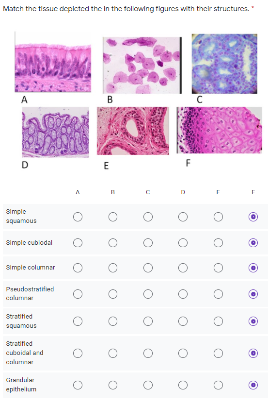 Match the tissue depicted the in the following figures with their structures. *
A
B
D
E
F
A
E
Simple
squamous
Simple cubiodal
Simple columnar
Pseudostratified
columnar
Stratified
squamous
Stratified
cuboidal and
columnar
Grandular
epithelium
B.
