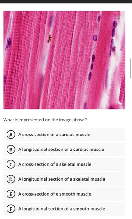 What is represented on the image above?
A A cross-section of a cardiac muscle
B A longitudinal section of a cardiac muscle
A cross-section of a skeletal muscle
A longitudinal section of a skeletal muscle
EA cross-section of e smooth muscle
F) A longitudinal section of a smooth muscle
