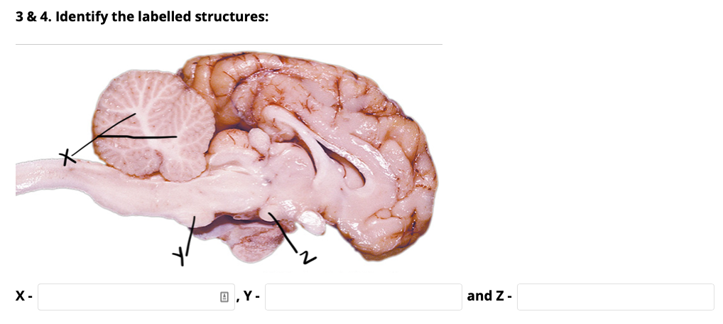 3 & 4. Identify the labelled structures:
X-
O ,Y-
and Z-
