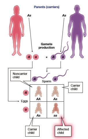 Parents (carriers)
Aa
Aa
Gamete
production
Noncarrior
child
Sperm
Carrier
child
AA
Aa
Eggs
Aa
aa
Carrier
child
Affected
child
