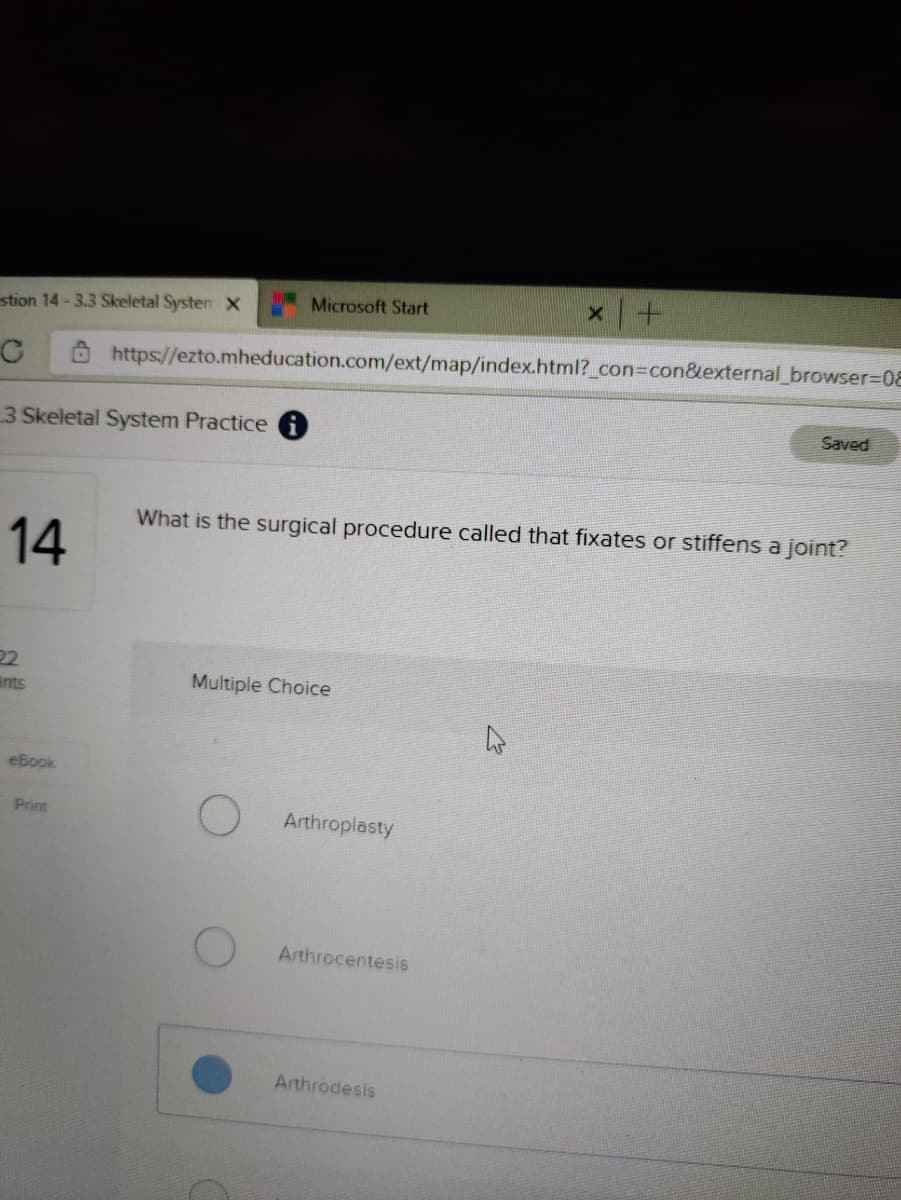 Microsoft Start
stion 14 - 3.3 Skeletal Systen X
https://ezto.mheducation.com/ext/map/index.html?_con%3Dcon&external_browser=D08
Saved
3 Skeletal System Practice 0
What is the surgical procedure called that fixates or stiffens a joint?
14
22
ants
Multiple Choice
eBook
Print
Arthroplasty
Arthrocentesis
Arthrodesis
