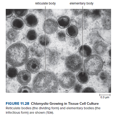 reticulate body
elementary body
'0.3 um
FIGURE 11.28 Chlamydla Growing In Tissue Cell Culture
Reticulate bodles (the dividing form) and elementary bodles (the
Infectious form) are shown (TEM).
