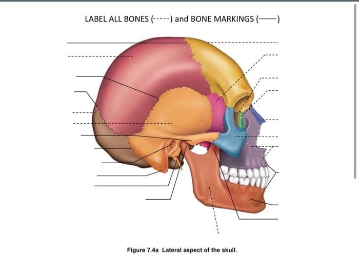 LABEL ALL BONES (---) and BONE MARKINGS (-)
CARM
Figure 7.4a Lateral aspect of the skull.