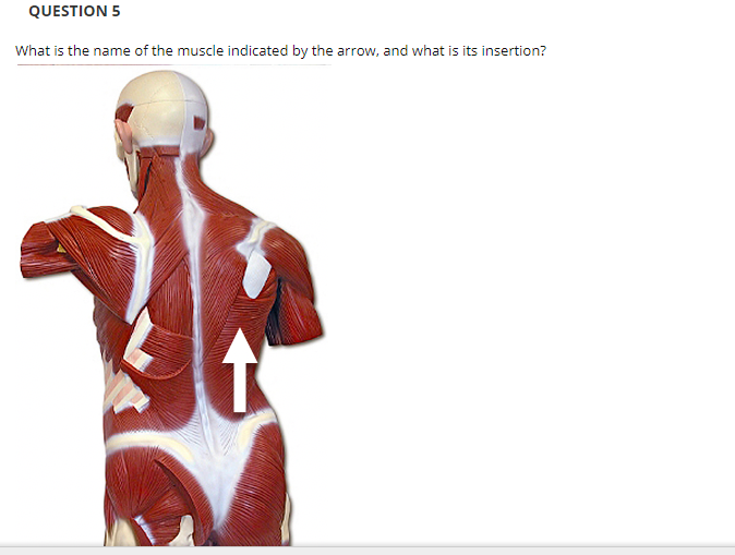 QUESTION 5
What is the name of the muscle indicated by the arrow, and what is its insertion?
to
