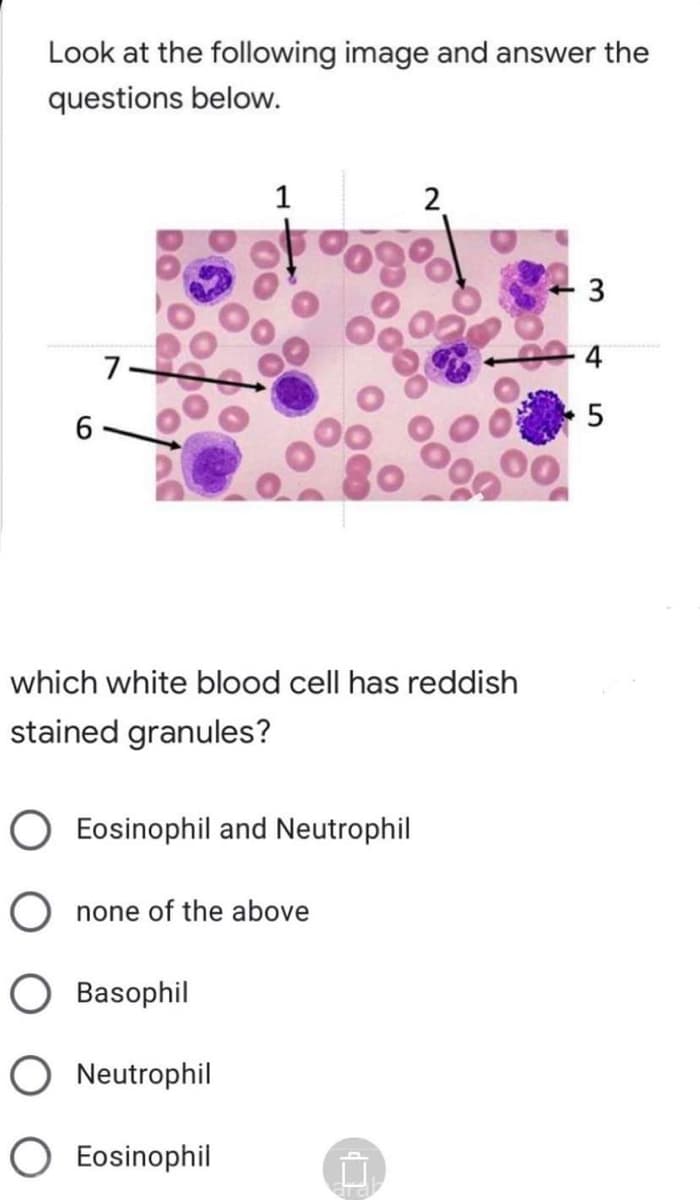 Look at the following image and answer the
questions below.
2.
3
7.
4
6.
which white blood cell has reddish
stained granules?
O Eosinophil and Neutrophil
O none of the above
Basophil
O Neutrophil
Eosinophil
