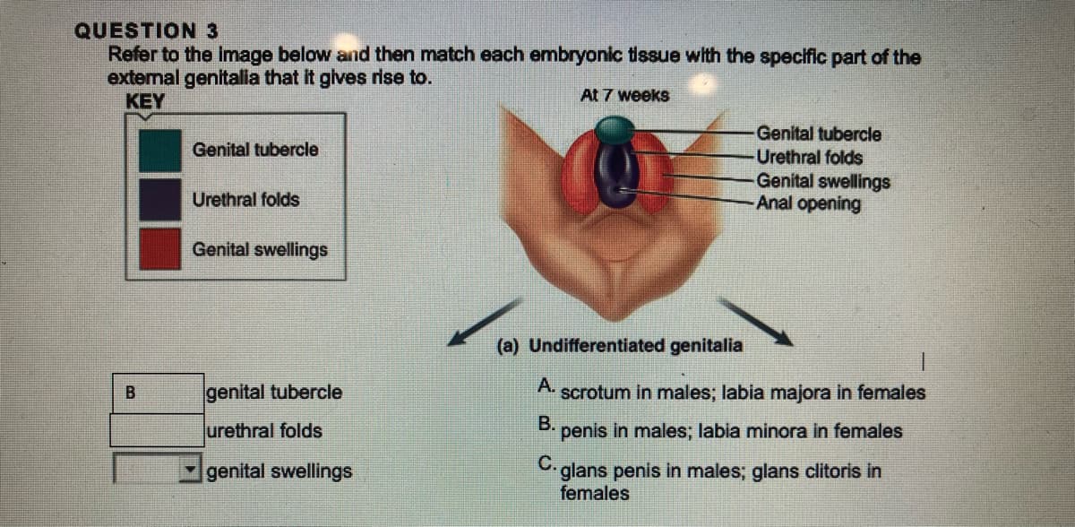 QUESTION 3
Refer to the image below and then match each embryonic tissue with the specific part of the
external genitalia that it gives rise to.
At 7 weeks
KEY
B
Genital tubercle
Urethral folds
Genital swellings
genital tubercle
urethral folds
genital swellings
(a) Undifferentiated genitalia
Genital tubercle
-Urethral folds
Genital swellings
-Anal opening
A.
scrotum in males; labia majora in females
B.
penis in males; labia minora in females
C.
glans penis in males; glans clitoris in
females