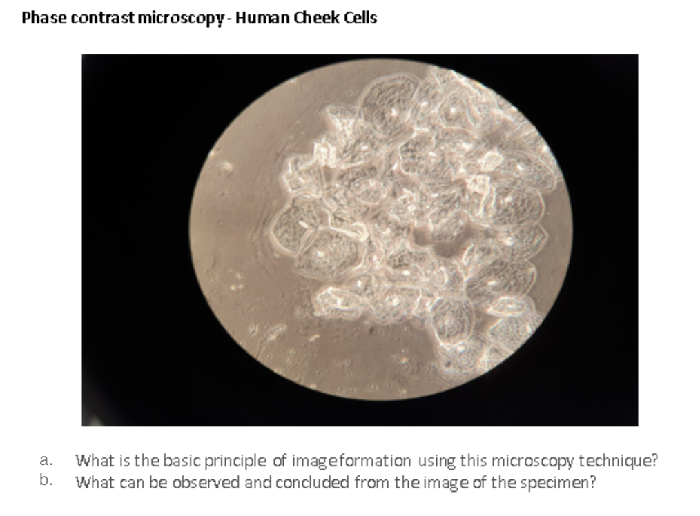 Phase contrast microscopy - Human Cheek Cells
a.
b.
What is the basic principle of image formation using this microscopy technique?
What can be observed and concluded from the image of the specimen?