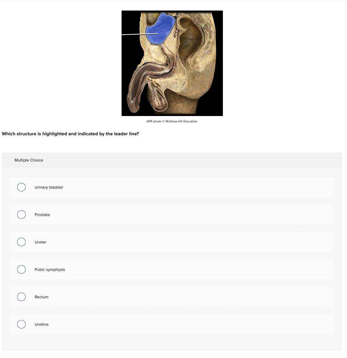 APR photo O McGraw-Hill Education
Which structure is highlighted and indicated by the leader line?
Multiple Choice
Urinary bladder
Prostate
Ureter
Pubic symphysis
Rectum
Urethra
