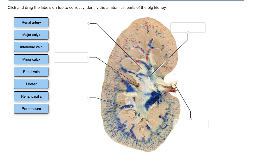 Click and drag the labels on top to correctly identify the anatomical parts of the pig kidney.
Renal artery
Major calyx
Interlobar vein
Minor calyx
Renal vein
Ureter
Renal papilla
Peritoneum
