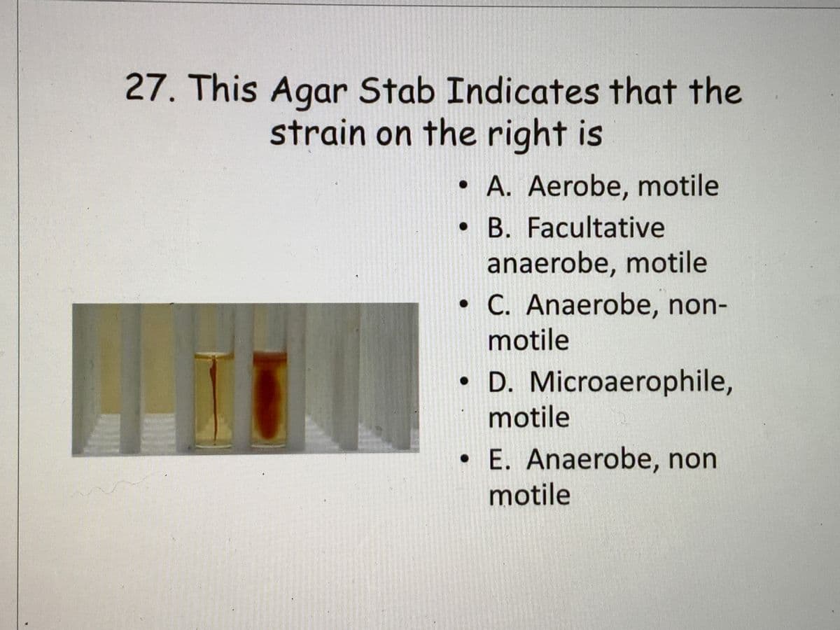 27. This Agar Stab Indicates that the
strain on the right is
• A. Aerobe, motile
• B. Facultative
anaerobe, motile
• C. Anaerobe, non-
motile
• D. Microaerophile,
motile
E. Anaerobe, non
motile
