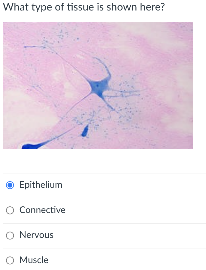 What type of tissue is shown here?
Epithelium
Connective
O Nervous
O Muscle
