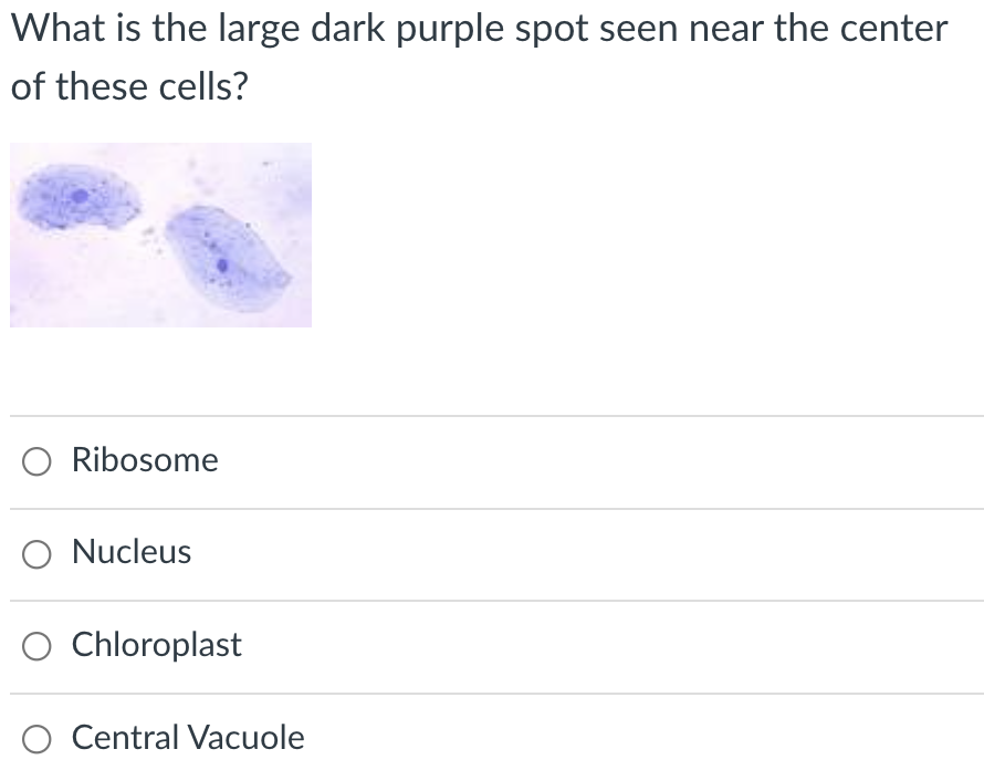 What is the large dark purple spot seen near the center
of these cells?
Ribosome
Nucleus
Chloroplast
Central Vacuole
