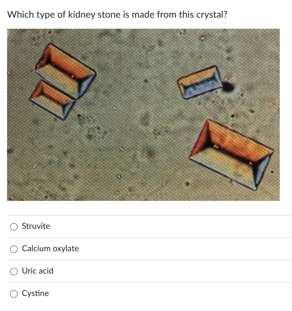 Which type of kidney stone is made from this crystal?
Struvite
Calcium oxylate
Uric acid
Cystine