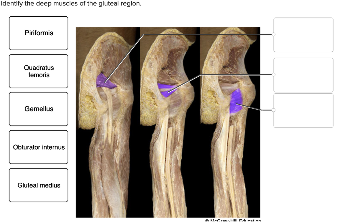 Identify the deep muscles of the gluteal region.
Piriformis
Quadratus
femoris
Gemellus
Obturator internus
Gluteal medius
@ McGraw-Hill Education
