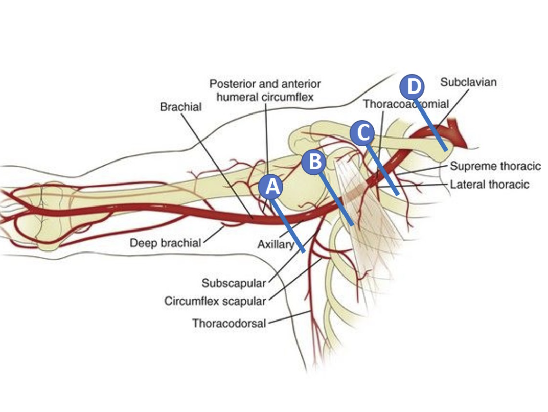 Subclavian
Posterior and anterior
humeral circumflex
Brachial
Thoracoadromial
B
A
Supreme thoracic
Lateral thoracic
Deep brachial
Axillary
Subscapular
Circumflex scapular
Thoracodorsal-
