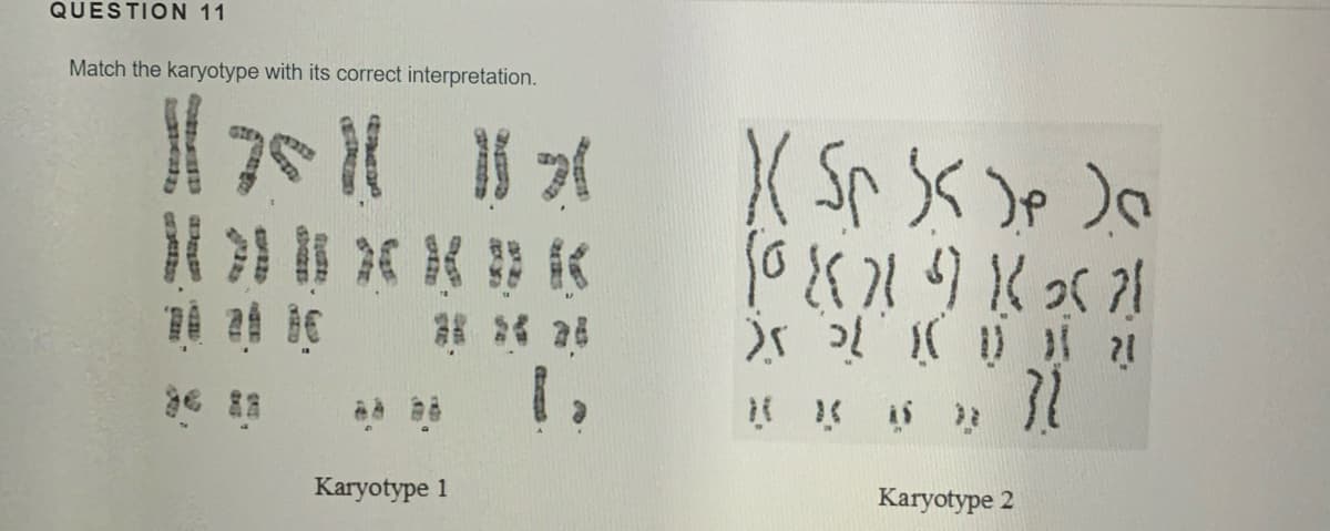 QUESTION 11
Match the karyotype with its correct interpretation.
Karyotype 1
Karyotype 2
t izs

