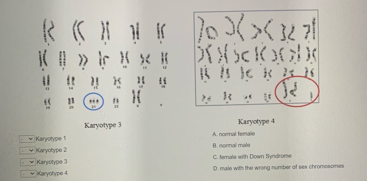 10
14
IS
16
17
18
19
20
21
22
Karyotype 4
Karyotype 3
A. normal female
v Karyotype 1
B. normal male
v Karyotype 2
C. female with Down Syndrome
v Karyotype 3
D. male with the wrong number of sex chromosomes
v Karyotype 4
