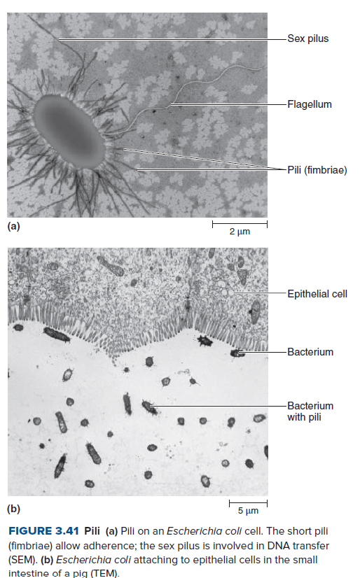 -Sex pilus
-Flagellum
-Pili (fimbriae)
(a)
2 µm
Epithelial cell
-Bacterium
-Bacterium
with pili
(b)
5 μη
FIGURE 3.41 Pili (a) Pili on an Escherichia coli cell. The short pili
(fimbriae) allow adherence; the sex pilus is involved in DNA transfer
(SEM). (b) Escherichia coli attaching to epithelial cells in the small
intestine of a pig (TEM).
