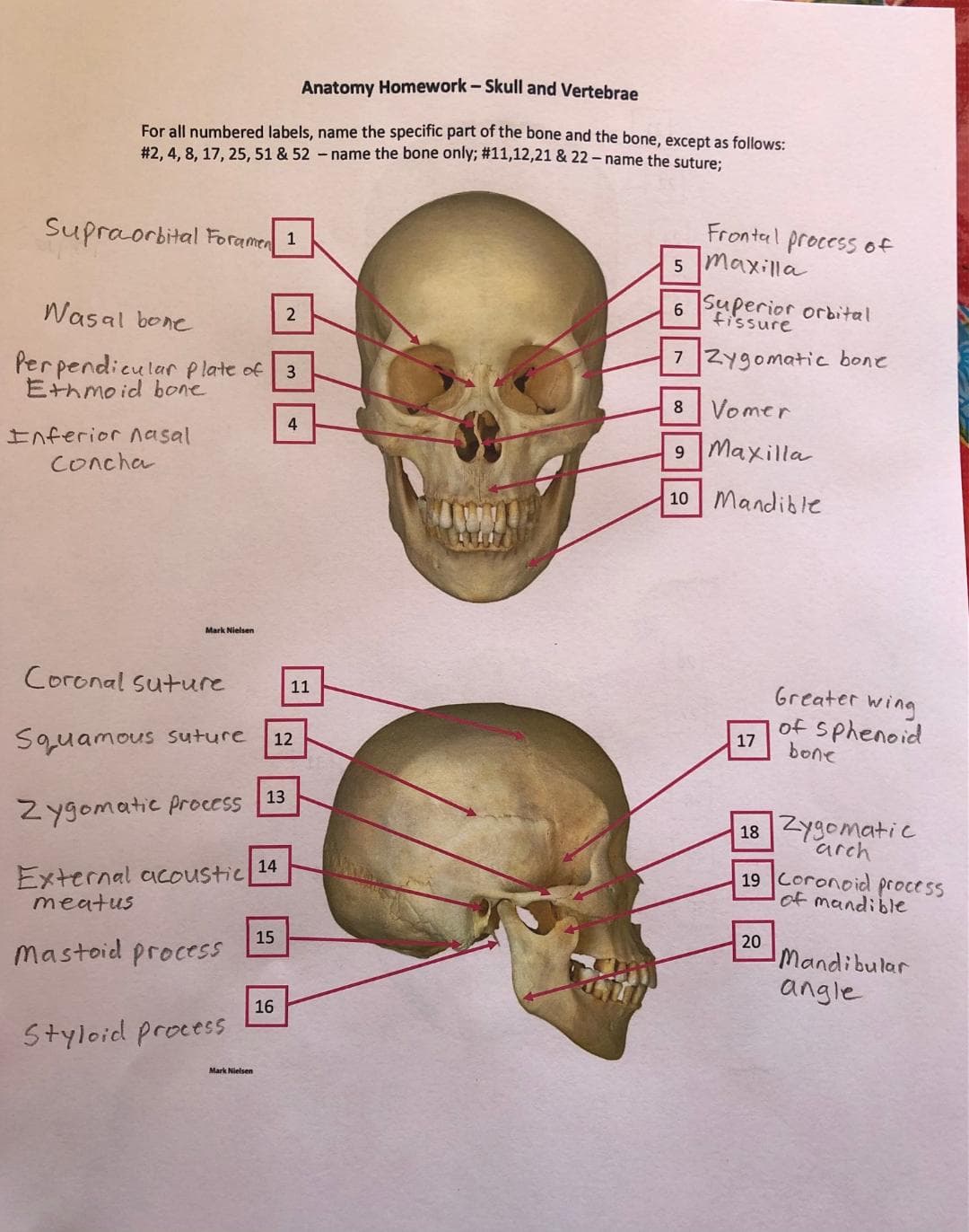 Anatomy Homework - Skull and Vertebrae
For all numbered labels, name the specific part of the bone and the bone, except as follows:
#2, 4, 8, 17, 25, 51 & 52-name the bone only; #11,12,21 & 22-name the suture:
Supraorbital Foramen 1
Frontal process of
maxilla
6 Superior orbital
fissure
Wasal bone
2
7ZY9omatic bone
Perpendicular p late of
Ethmoid bone
3
8 Vomer
4
9 Maxilla
Inferior asal
Concha
10 Mandible
Mark Nielsen
Coronal Suture
Greater wing
11
of Sphenoid
bone
17
12
Squamous suture
13
Zygomatic process
ZYgomatic
arch
18
19 Coronoid process
of mandible
14
External acoustic
meatus
20
Mandibular
15
Mastoid process
angle
16
Styloid process
Mark Nielsen
