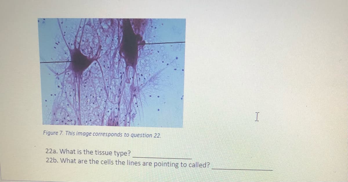Figure 7. This image corresponds to question 22.
22a. What is the tissue type?
22b. What are the cells the lines are pointing to called?

