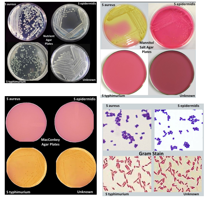 S aureus
Styphimurium
S aureus
S typhimurium
Nutrient
Agar
Plates
MacConkey
Agar Plates
S epidermidis
Unknown
S epidermidis
Unknown
S aureus
S typhimurium
S aureus
S typhimurium
Mannitol
Salt Agar
Plates
Gram Stain
S epidermidis
Unknown
S epidermidis
Unknown