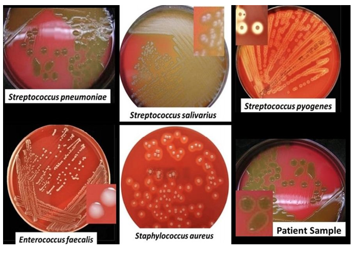 Streptococcus pneumoniae
.....
T
20.15
ways
Enterococcus faecalis
p
Puront
Streptococcus salivarius
Staphylococcus aureus
000
Exape and
Pen
Streptococcus pyogenes
Patient Sample