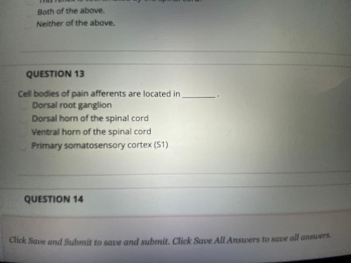 Both of the above.
Neither of the above.
QUESTION 13
Cell bodies of pain afferents are located in
Dorsal root ganglion
Dorsal horn of the spinal cord
Ventral horn of the spinal cord
Primary somatosensory cortex (S1)
QUESTION 14
Click Save and Submit to saue and submit. Click Save All Answers to save all answers
