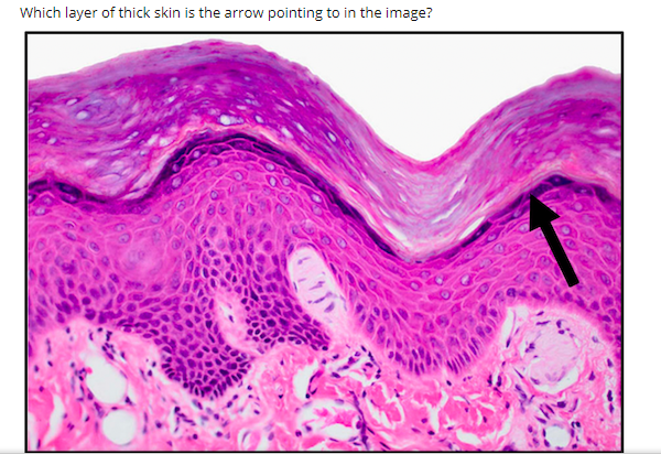 Which layer of thick skin is the arrow pointing to in the image?
