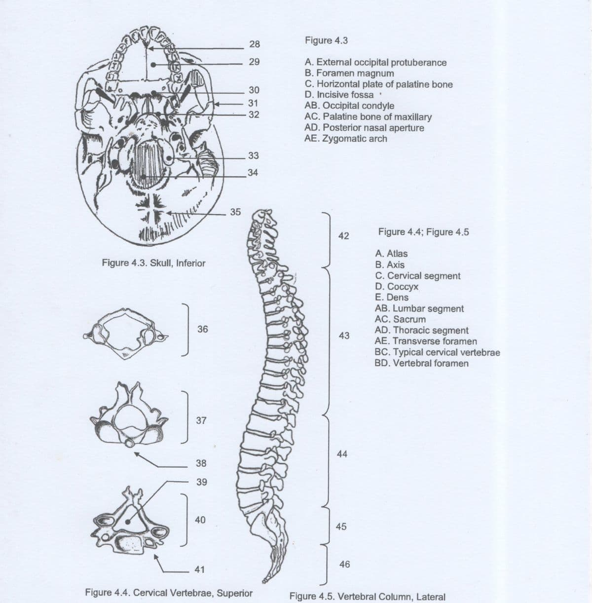 28
Figure 4.3
A. External occipital protuberance
B. Foramen magnum
29
C. Horizontal plate of palatine bone
D. Incisive fossa
AB. Occipital condyle
AC. Palatine bone of maxillary
AD. Posterior nasal aperture
AE. Zygomatic arch
30
31
32
33
34
35
42
Figure 4.4; Figure 4.5
A. Atlas
B. Axis
C. Cervical segment
D. Coccyx
E. Dens
AB. Lumbar segment
AC. Sacrum
AD. Thoracic segment
AE. Transverse foramen
Figure 4.3. Skull, Inferior
36
43
BC. Typical cervical vertebrae
BD. Vertebral foramen
37
44
38
39
40
45
46
41
Figure 4.4. Cervical Vertebrae, Superior
Figure 4.5. Vertebral Column, Lateral
