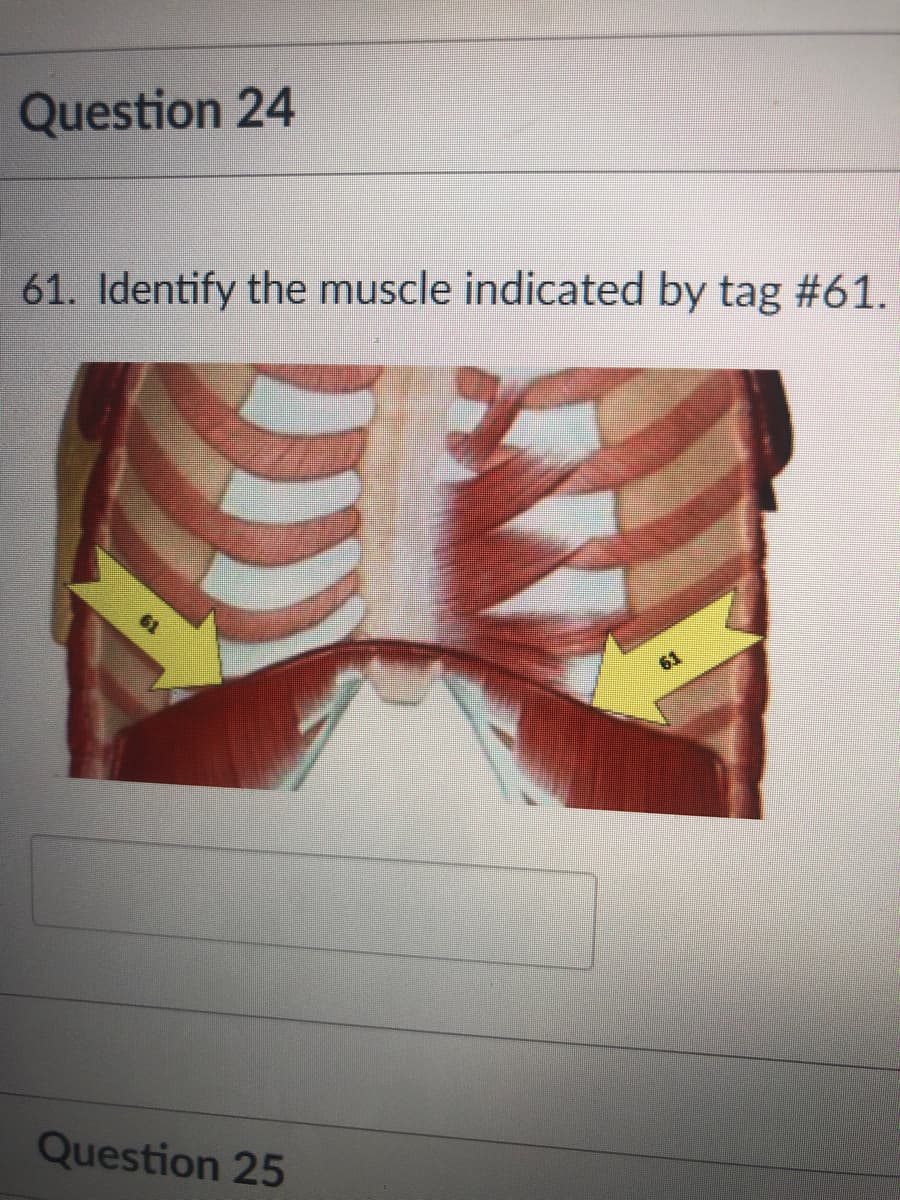 Question 24
61. Identify the muscle indicated by tag #61.
Question 25
