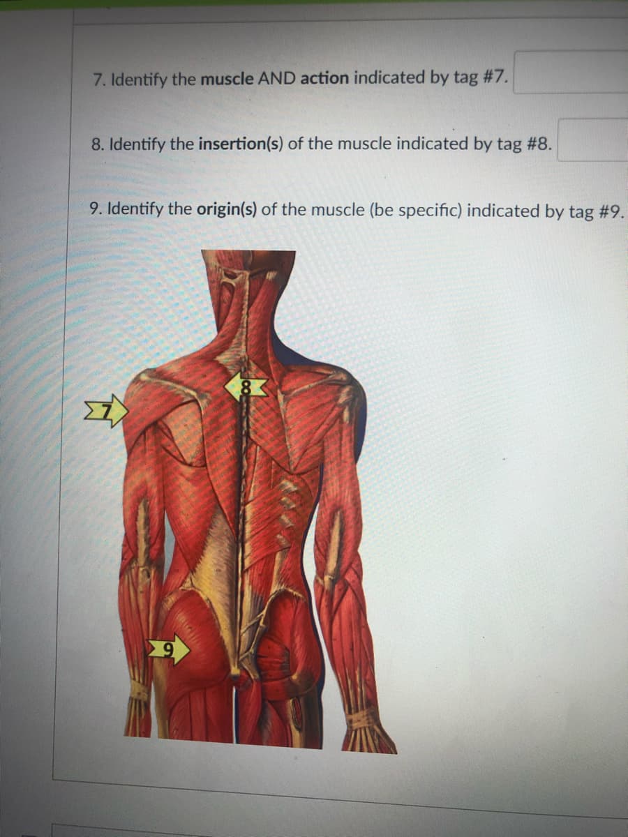 7. Identify the muscle AND action indicated by tag #7.
8. Identify the insertion(s) of the muscle indicated by tag #8.
9. Identify the origin(s) of the muscle (be specific) indicated by tag #9.
